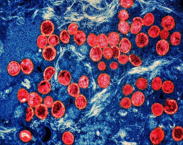 Monkeypox_Virus_(52341717993)