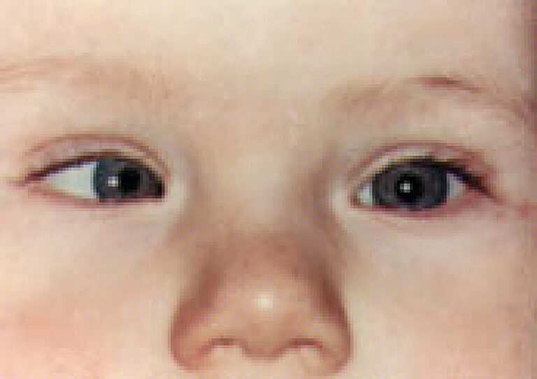 5445430946_6fd8fe755a_b