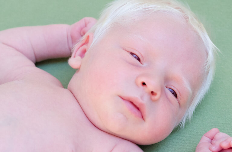 Albino_baby_by_Felipe_Fernandes_02