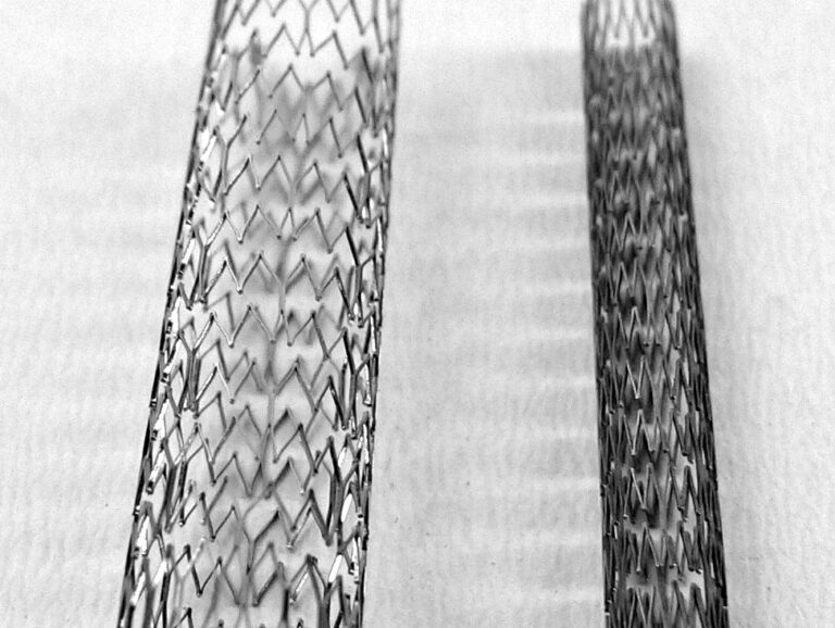 Stent4_(fcm)