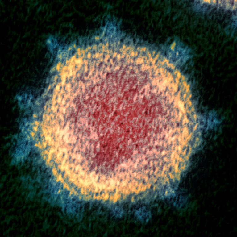 Novel_Coronavirus_SARS-CoV-2_(crop)